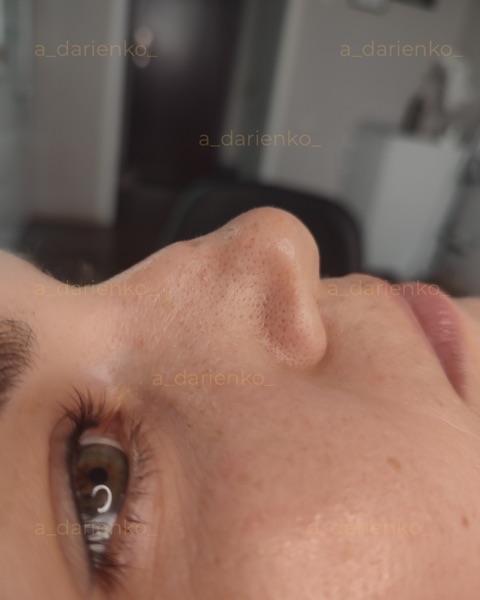 До процедури — косметолог Миколаїв